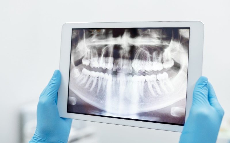 Radiografia dental